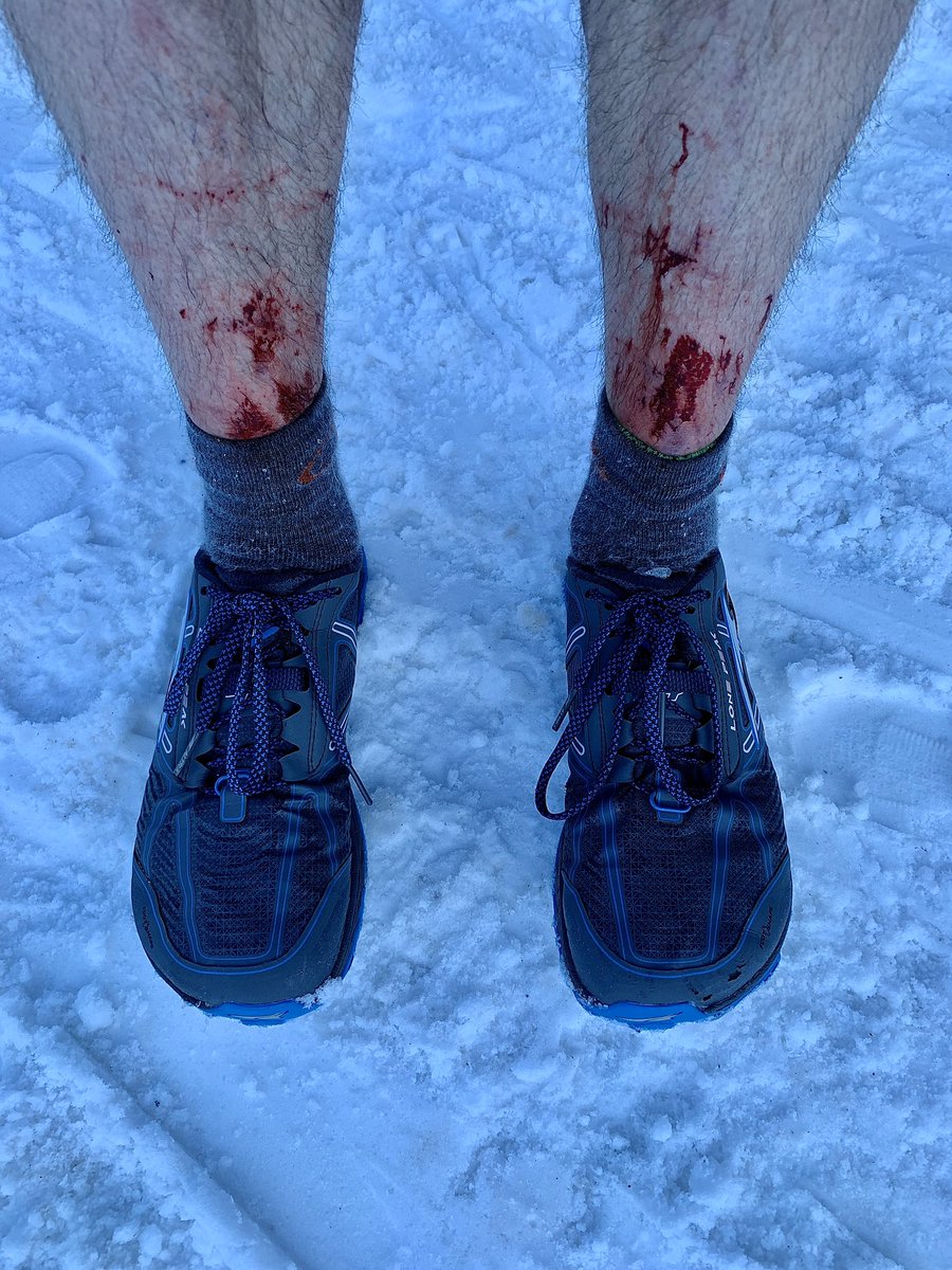 trailultrasaur's tweet photo. Maybe full length tights would have been the smart choice...
Fair to say that I misjudged trail conditions at the nordic centre today...anything a few km out is crusty post-holing that will eat your shins!!!
#winterrunning #postholing #showerisgonnahurt
@altrarunning https://t.co/0O9MAj2O2Z