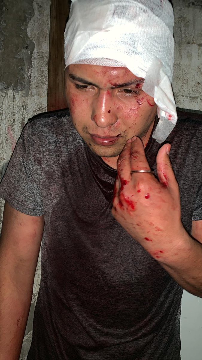 aprachile's tweet photo. 🔴🔴🔴Carabinero es golpeado brutalmente por un turba mientras conducía su vehículo particular, junto a su familia en Antofagasta https://t.co/n22j0LWfTQ