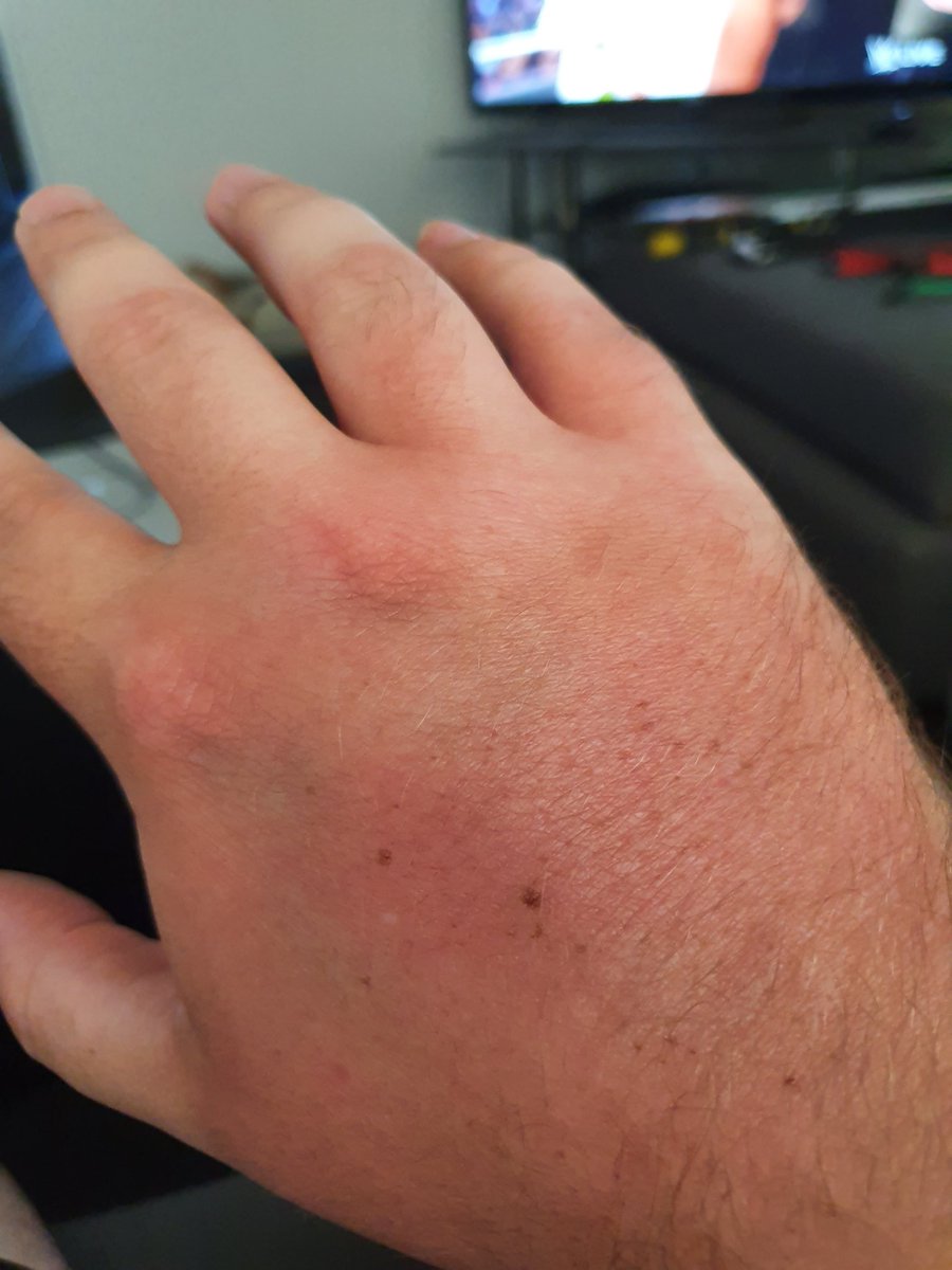 DrewRickard's tweet image. When golf club meets tree root. #golfishard #howgoodisgolf