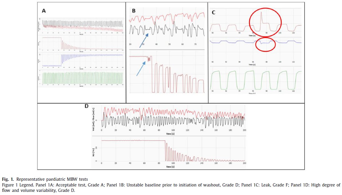 Published in #JournalCF is new evidence demonstrating the utility of lung clearance index as an effective primary endpoint in #cysticfibrosis phase III clinical trial. ow.ly/BaLp50xCPYF