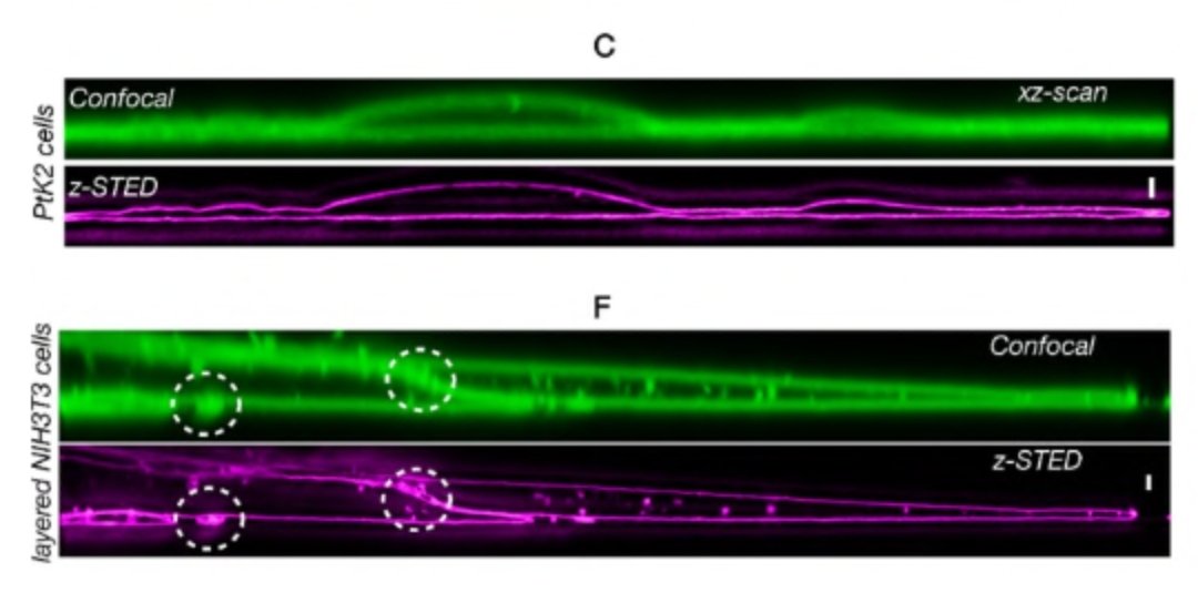aurel_barbotin's tweet photo. Our new preprint is out! We explored the possibilities offered by z-STED to study the plasma membrane. I am very happy with the results! @Sciezgin @ProfMartinJBoo1 @AgEggeling @uiztok https://t.co/OIcsRi8nsA https://t.co/Yf3BzH0NME