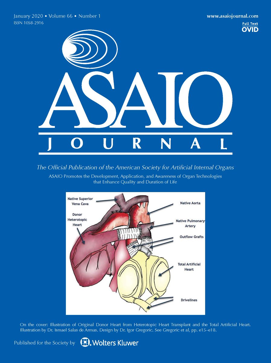 asaiojournal's tweet photo. Happy New Year! The January 2020 issue is online!
https://t.co/vkr0H4N6iA
#HeartFailure #LVAD #exercise #ECMO #Sepsis #RVFunction #HVAD #thrombosis #perfusion #PedsICU #pedECMO #Hemodialysis #MyocardialRecovery #LungFailure #ECLS #TAH #DCD #OrganDonation #CardioTwitter https://t.co/m3TVgY2VRa