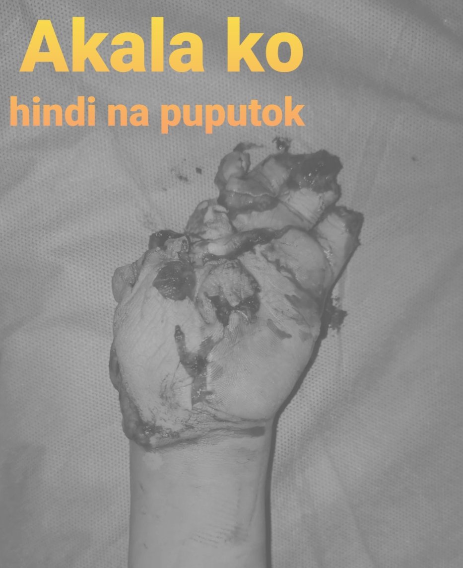 Hand Surgeons Ph tweet media