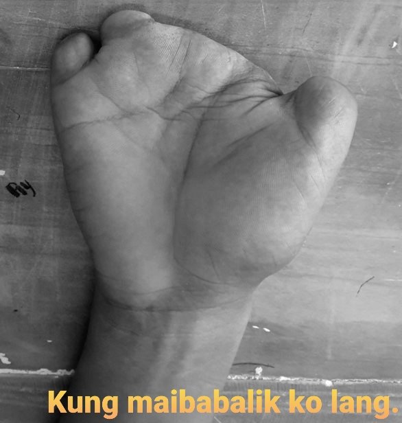 Hand Surgeons Ph tweet media