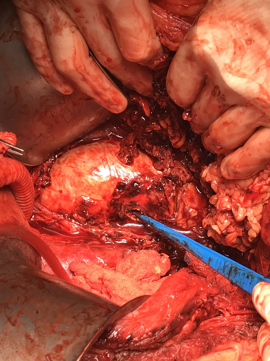 Rami Tadros tweet media