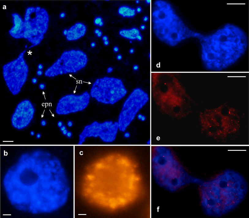 sci_plant's tweet photo. Endoreplication and its consequences in the suspensor of Pisum sativum

https://t.co/zmE2OMy855
#sciplant #scicomm #Endoreplication @PlantCellRep ♻️ https://t.co/PANQoRzfai