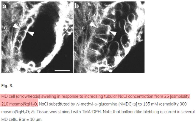 9/When exposed to high levels of Cl (and Na) the macula densa cells literally swell. https://www.ncbi.nlm.nih.gov/pubmed/12060602 