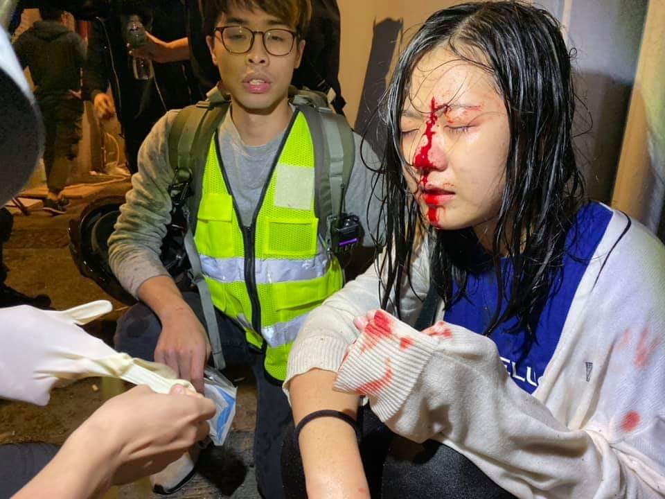 IamMsFF's tweet photo. 2020 first punch from #hkpf , a woman hitted injured by Water Cannon in Monk Kok.
@Olympics see that ! #Hkers are exploed freedom rights walking into street and facong humanitarianism threatened of #HKPF !
#stopBeijing2022 !sanctions #CCP!
@SolomonYue 
@benedictrogers 

#soshk https://t.co/z5qcCrdx83