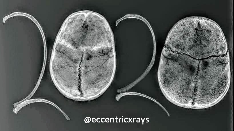 eccentricxrays's tweet photo. #HappyNewYear #newdecade #happy2020 https://t.co/9KVyBgf1dt