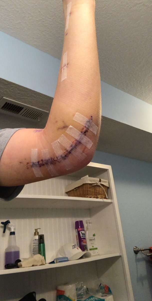 _Caudiewatson's tweet image. Here’s to a year of rehab and coming back better than ever. See you in spring of ‘21