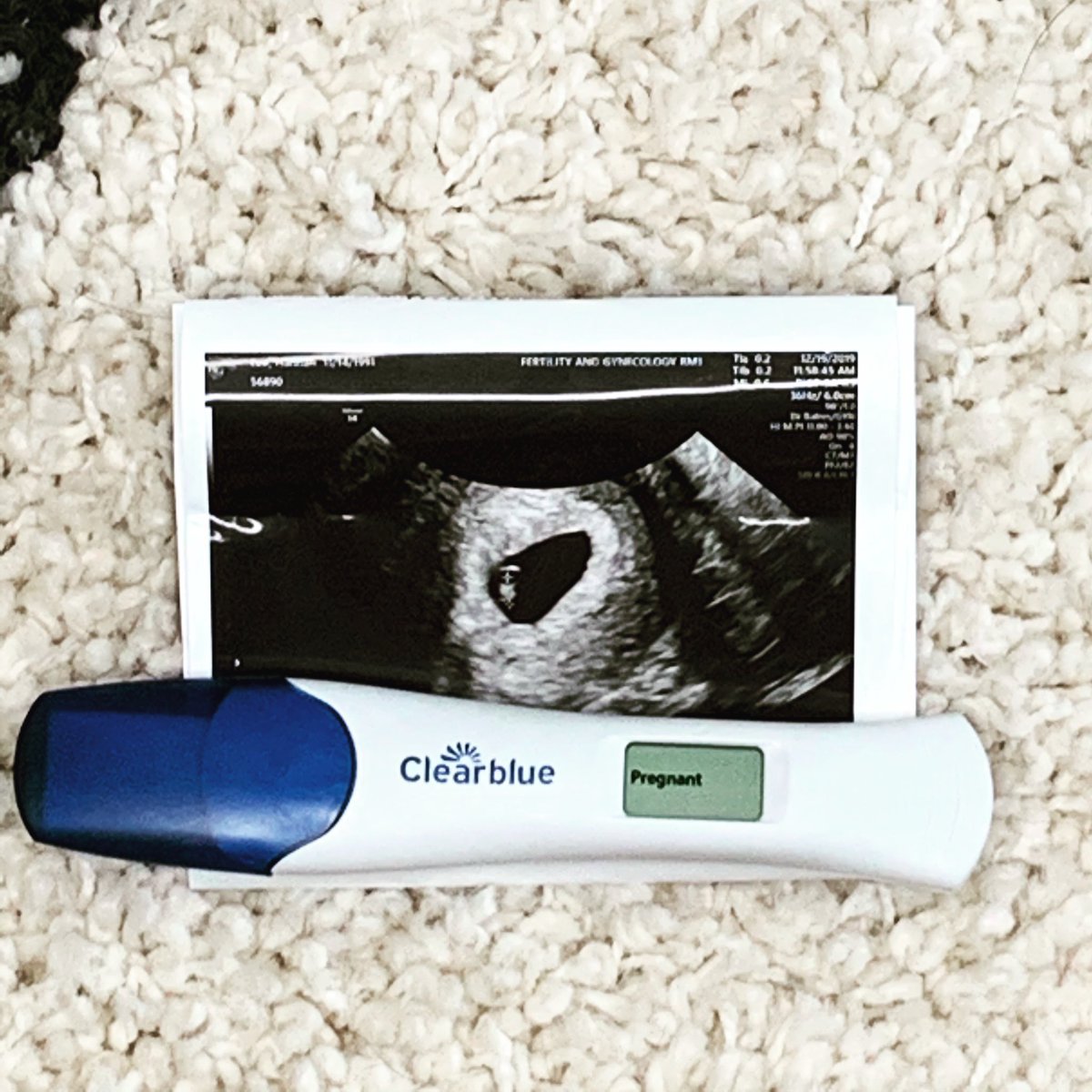 HannahLee61's tweet photo. I have a feeling 2020 is gonna be a good one for us @Grizzlee2378 #newyearnewLee https://t.co/rrvgvQ2Puk