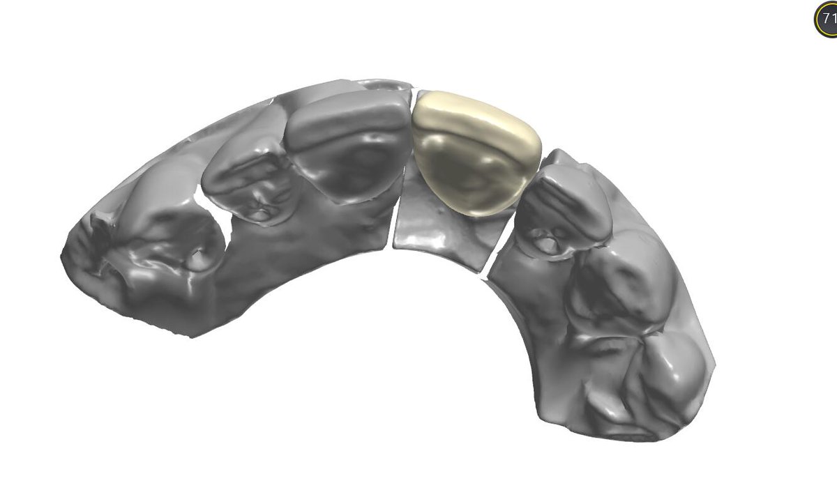 ImpChenCAD's tweet photo. Dear sir
Ian Dental Design Studio, if you need to outsource design dental crowns, veneers, models, implants.
contact me .WeChat：+8618318409059/email：18318409059@163.com/WhatsAPP:+8618318409059 https://t.co/4EQBnWb2wN