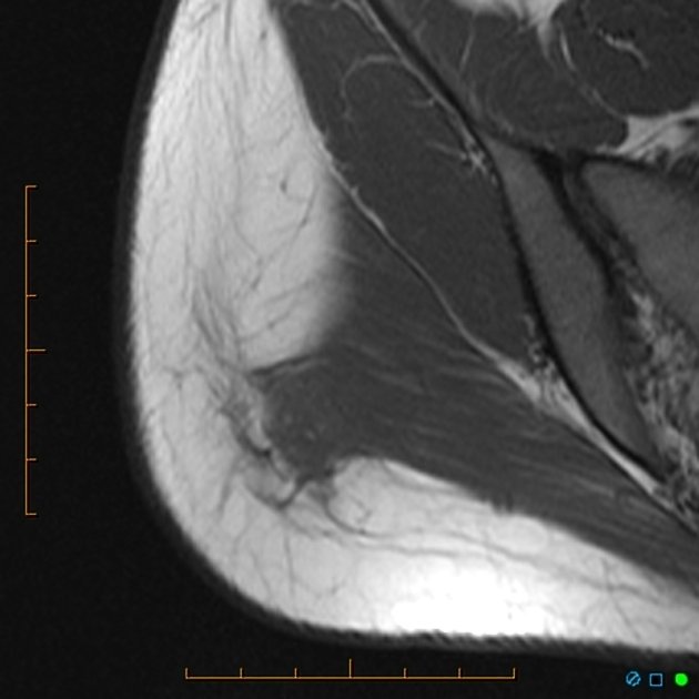 RayGGreene's tweet image. Hey it's you, MRI-ass! @Emerrias