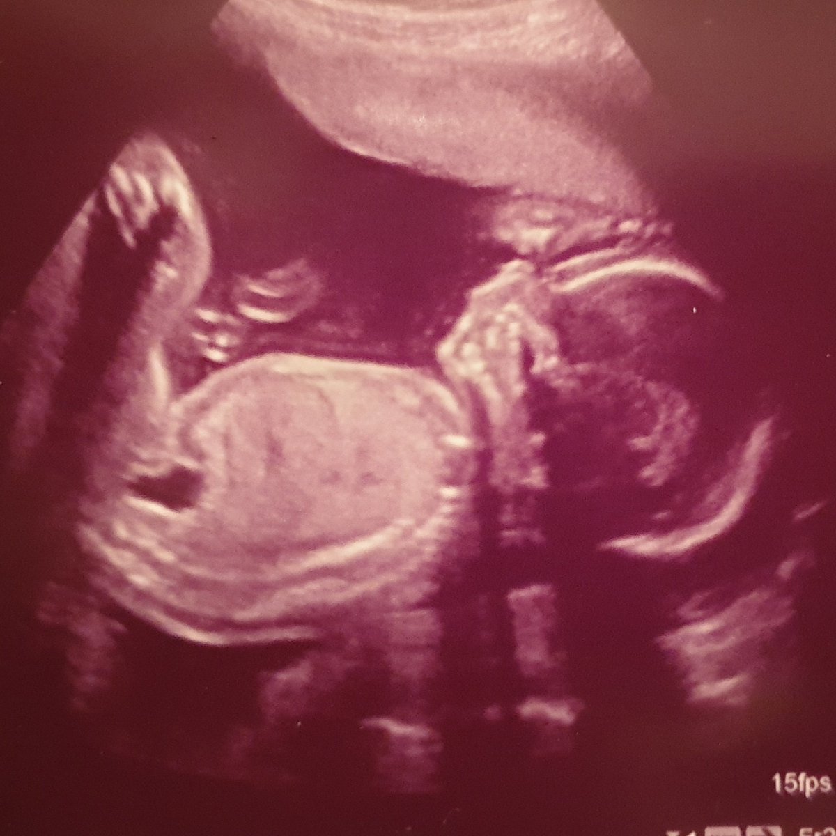 2020 is going to be a slightly different year #rollonmay