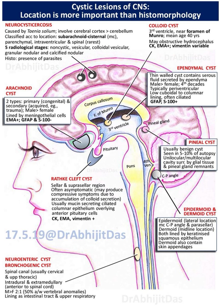 AbhijitSurgPath's tweet photo. #CysticLesionsCNS #ImportantEntities #BriefOverviewForResidents #MakeNeuropathEasy https://t.co/m7uAUNTSdp