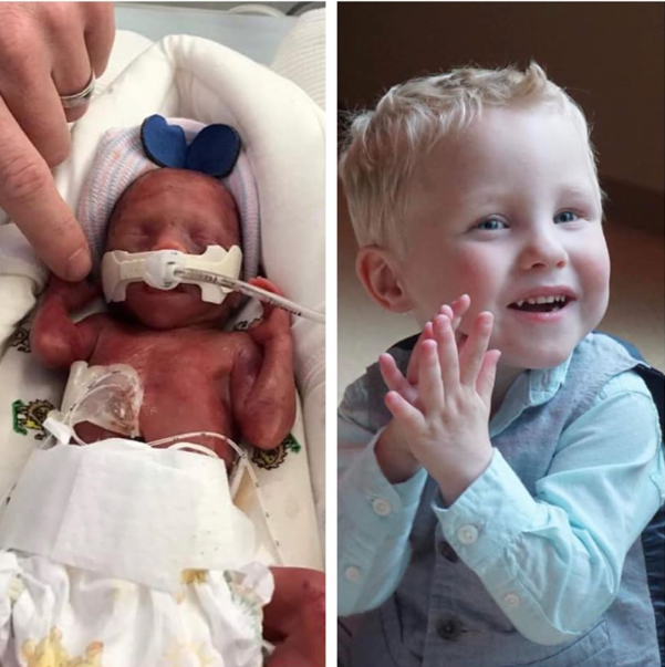 Geboren met 22 weken en 4 dagen.

Als mens en als niets anders.

facebook.com/amomentwithkai…