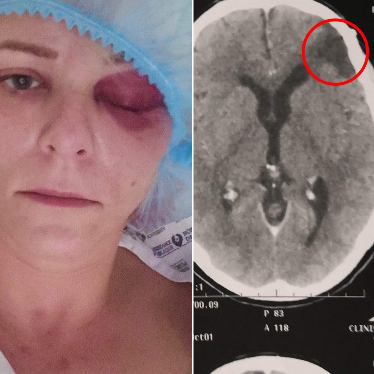 Rémi Gaillard tweet media