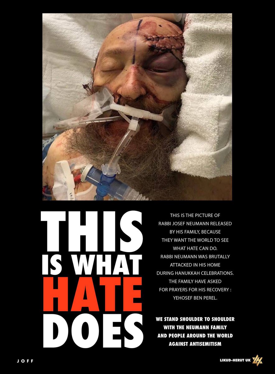 LikudUK's tweet photo. No doubt you will be as shocked and upset as we are on first seeing this picture.This is the face of Rabbi Neumann following a vile #antisemitic attack in his own home in #Monsey NY. We, along with Rabbi Neumann's family,ask you to share this far and wide,using the hashtag #WeJew https://t.co/qRhtuyeK6O