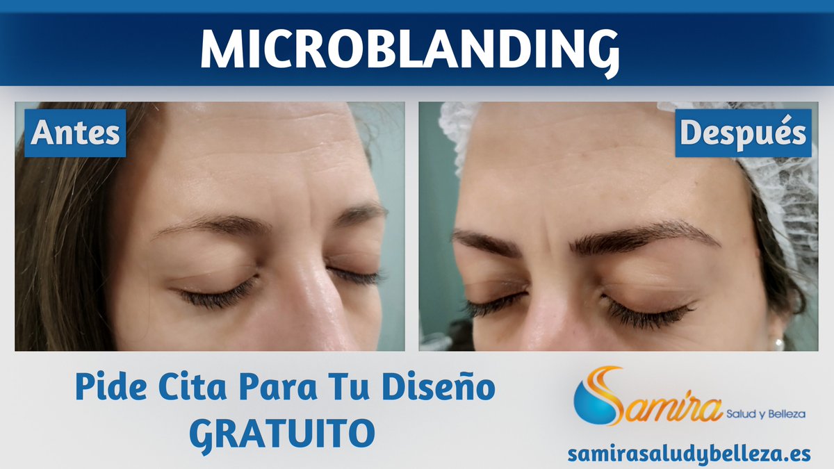 SamiraSyB's tweet photo. Aquí os dejo el antes y después de un tratamiento de Microblanding de una de nuestras clientas. ¿Os gusta el resultado?

Puedes pedir cita en
949 255 379 / 682 729 521

9 Avenida del Ejército
19004 Guadalajara (España)
#microblanding #cejas #perfectas #samira #guadalajara https://t.co/PL8O1Dv1Io