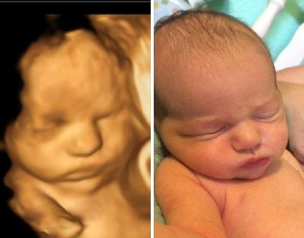 YouthforLifeNI1's tweet photo. Abortion was the leading cause of death in 2019 with OVER 42 million children killed before birth. Each of those 42.4 million abortions represents a living, unrepeatable human being. Today, at the start of 2020, let's all recommit to making abortion unthinkable.

#prolife2020 https://t.co/Mm7OMYqR26