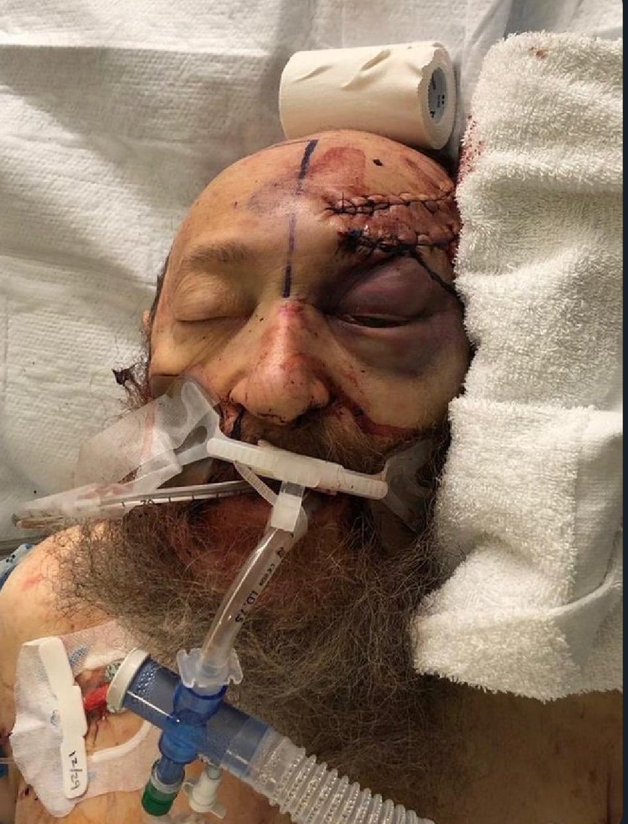 pinkhippos10's tweet photo. "A picture is worth a thousand words." Here are pictures that say more than I ever can. #mejew https://t.co/Oq8UB9MWyr