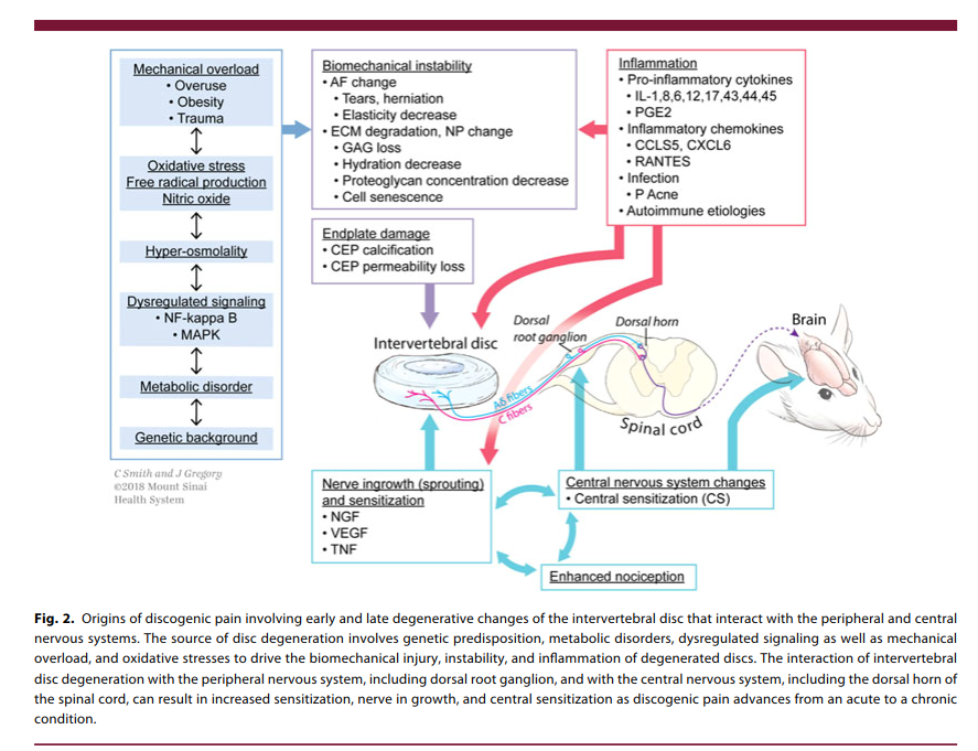 PhysioMeScience's tweet photo. Discogenic Back Pain: Literature Review of Definition, Diagnosis, and Treatment

https://t.co/g2j6GC1NUZ https://t.co/nrIKI1kysp