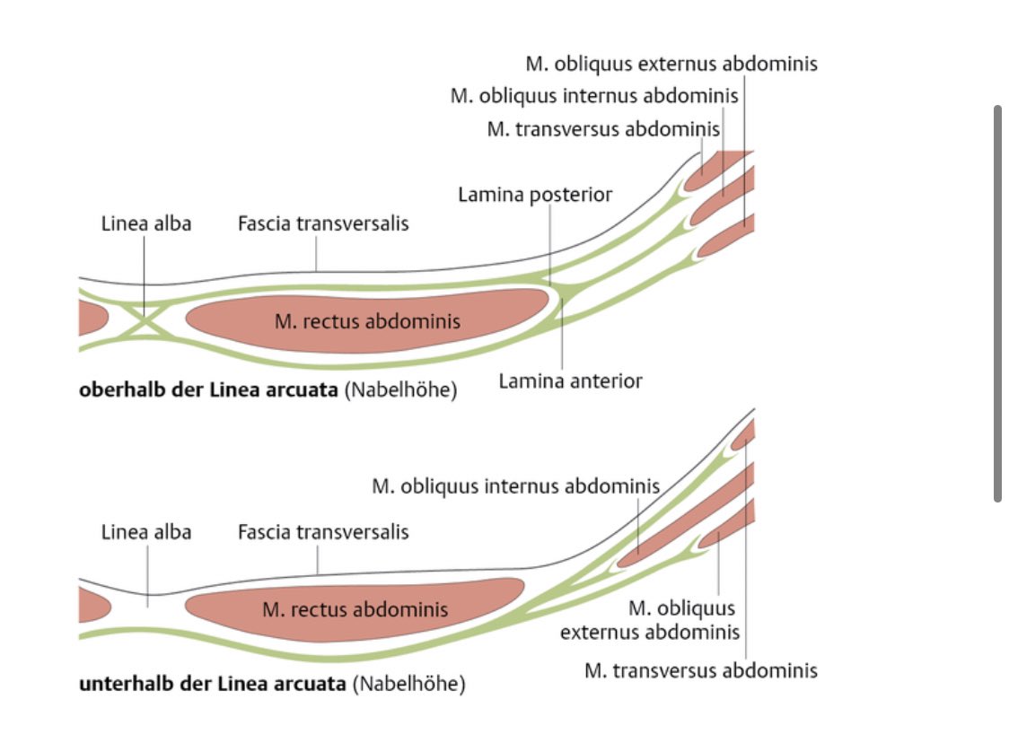 And the increase of abdominal pressure in order to cough for example. Extra for meds: rectus sheathThe rectus sheath is formed by the aponeuroses of the other abdominal muscles: Musculus obliquus externus abdominis, obliquus internus abdominis and transversus abdominis