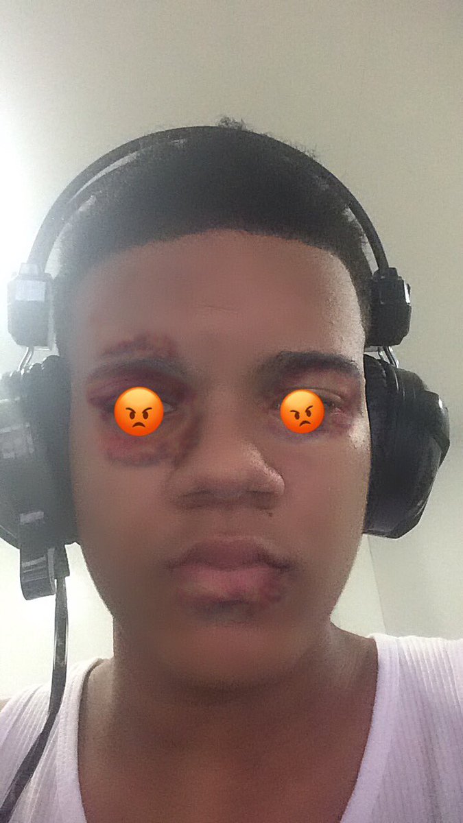 rh7oficiall's tweet image. Quando a polícia perguntar onde fica a “boca” eu juro que nunca mais digo q fica embaixo do nariz