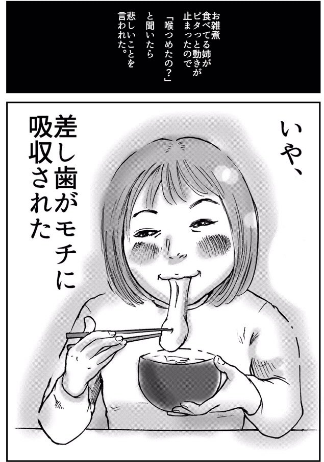 お雑煮で差し歯が抜けた姉の話です。 