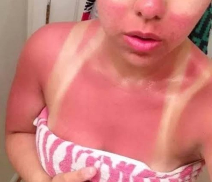 isabela_w's tweet photo. Eu tentando ficar bronzeada: A
Eu tbm: https://t.co/MPERahpMot