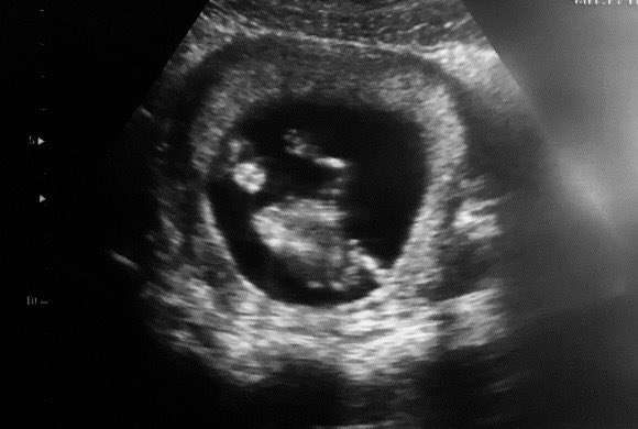 My son sent me this sonogram pic for Christmas. This will be my first grandbaby—a Boy. This sonogram was done at just 12 weeks. My son said they couldn’t see the baby &amp; asked the dr where the baby was &amp; the baby threw his hand up &amp; waved at that very moment. Pretty amazing💕