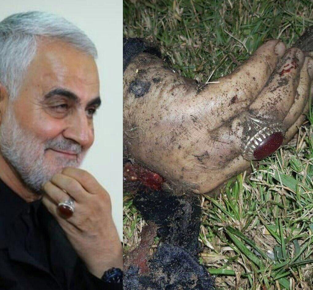 Restart1310's tweet photo. 🔴اولین شهید چیز خر !!
در حمله به فرودگاه عراق
تصویر دست قطع شده قاسم سلیمانی در شبکه های اجتماعی عربی منتشر شده است!
#شهید_چیز_خر
چون زمستان پنجمین بگذشت....
#Restart_will_make_iran_great_again
#interview_restartleader
#Restart_opposition
#Seyed_Mohammad_Hosseini
_ https://t.co/D8icmvlvgp