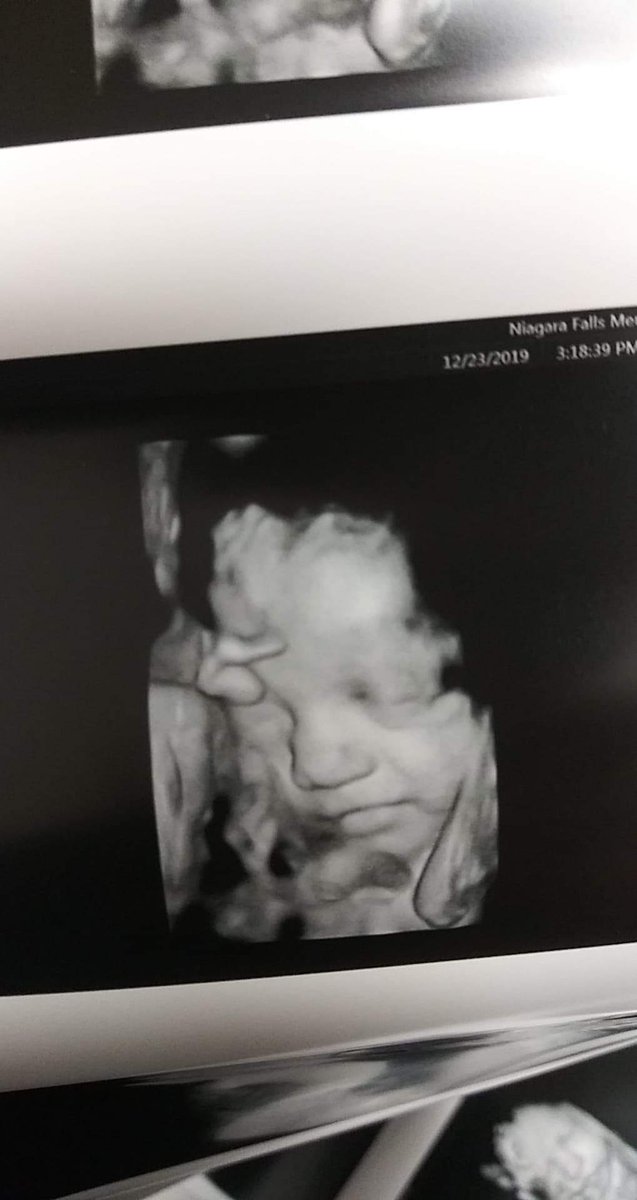 BarbaraDicken11's tweet photo. My smirking lil unborn... She is all ready absolutely beautiful in my eyes. ❤️ https://t.co/4qWcTjPXIc
