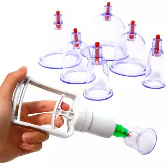 sandhya_engg's tweet image. Cupping Set☑️☑️

✅Ask for best deal
------------------------------
Panchakarma Equipments Suppliers, Ayurveda Equipment for sale India : Panchakarma Equipments
facebook.com/sandhyaenggwor…