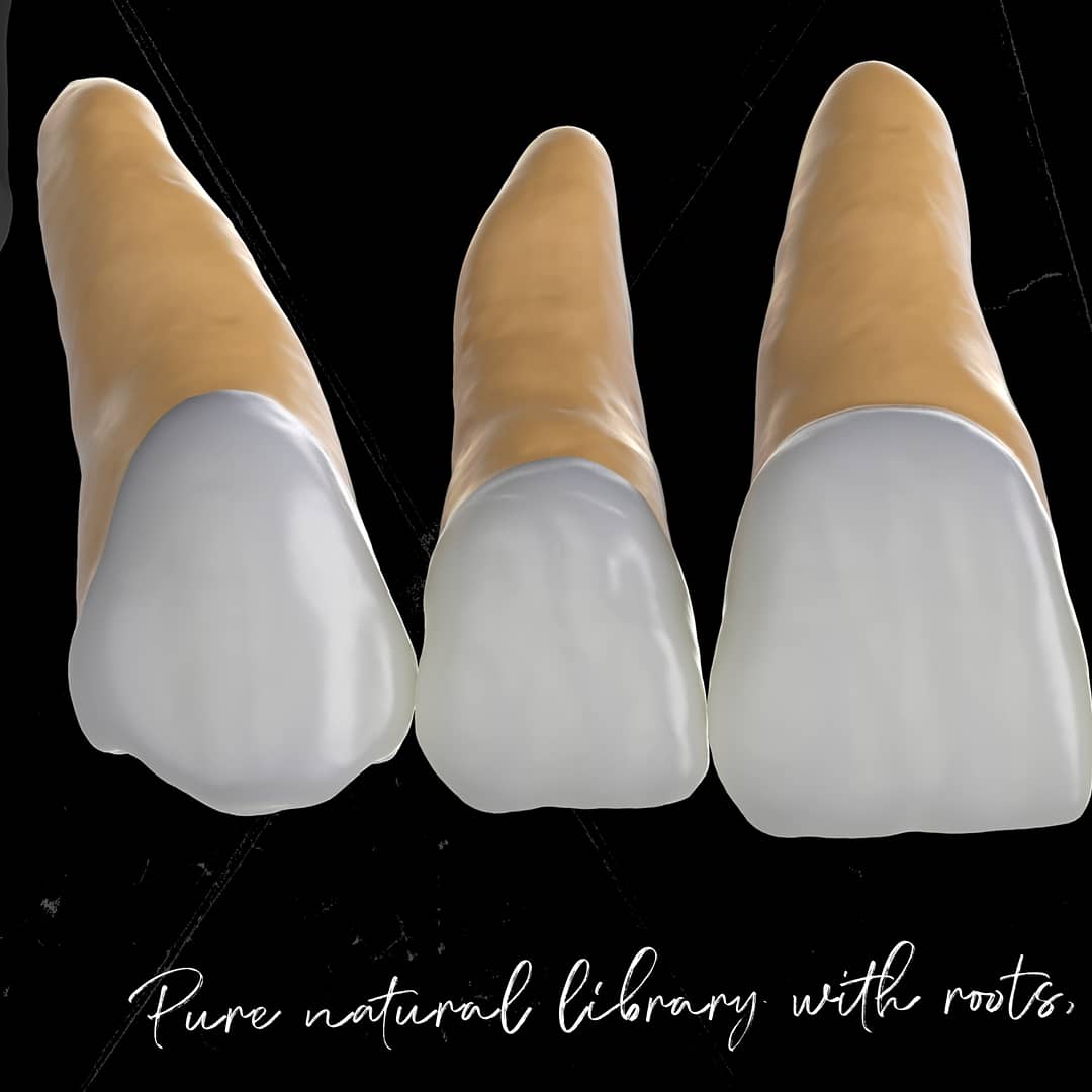 LorantStumpf's tweet photo. #digital, #dentistry, #cad, #cam, #digitaldentistry, #cerec, #3shape, #3shapetrios, #implants, #digitalsolution, #digitalrestoration, #dentallab, #printing, #exocad, #education, #technology, #digitalworkflow,#cadcamdentistry, #dentaltraining, #dentalschool, #crowns, #milling, https://t.co/Lprc6Up7rB