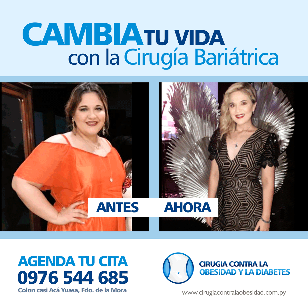 Bariatricapy's tweet photo. CAMBIA TU VIDA CON LA CIRUGÍA BARIÁTRICA. Estamos en: 📍https://t.co/lCdVWc5n2b - 📲AGENDA TU CITA (0976) 544 685 #CirugiaBariatrica #VivirSinObesidad #VivirSano #VivirSinDiabetes https://t.co/fXRIepk1UN