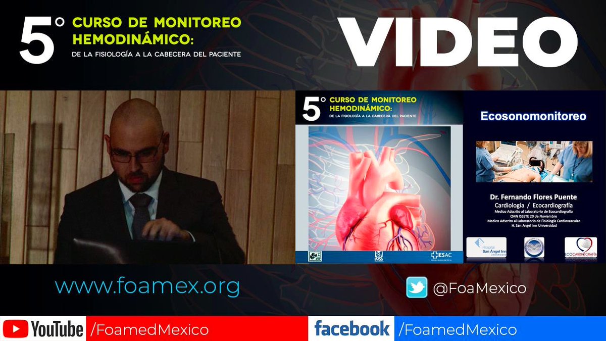 FOAMexico's tweet photo. VIDEO NUEVO 🎬
🔝🔝🔥
Ecosonomonitoreo‼️
Dr. Fernando Flores Puente
Cardiología/Ecocardiografía 🇲🇽
@FeRFloresPuente
📝 SUSCRÍBETE (Estreno Hoy)
🔜 https://t.co/mq6mOZYTgI
#PoCUS #FOAMed #FOAMex
#FOAMexChannel #MonitoreoHem2020 https://t.co/0UA5SHw9O2