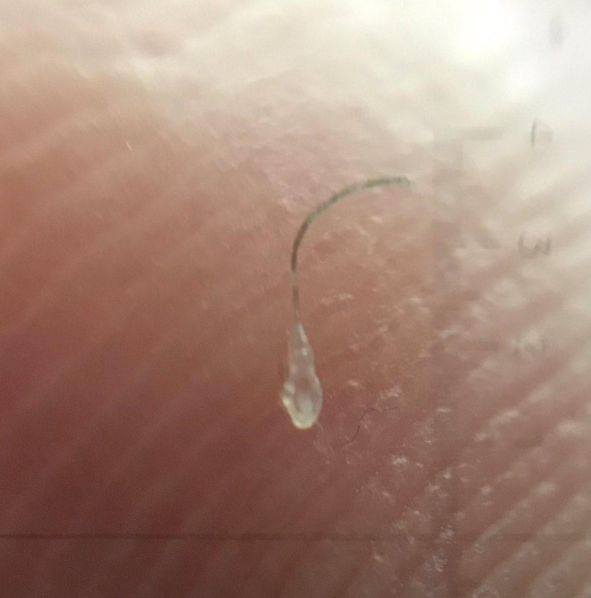 Compの中の人 ヒゲを毟り取ってルーペで見たら 毛根が超キレイな透明だった 拡大すると世界変わるよね しばし時間を忘れて観察 はぁ 楽しい Compの中の人 ヒゲを毟り取ってルーペで見たら 毛根が超キレイな透明だった 拡大すると世界変わるよね しばし時間を忘れて観察 はぁ 楽しい