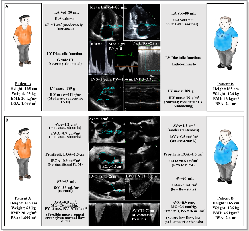 gonzaeperez's tweet photo. Echocardiographic Imaging Challenges in Obesity: Guideline Recommendations and Limitations of Adjusting to Body Size
@JAHA_AHA @pattypellikka #EchoFirst #cardiotwitter 

https://t.co/PnUL0HkbIX https://t.co/ngb8BUrf9y