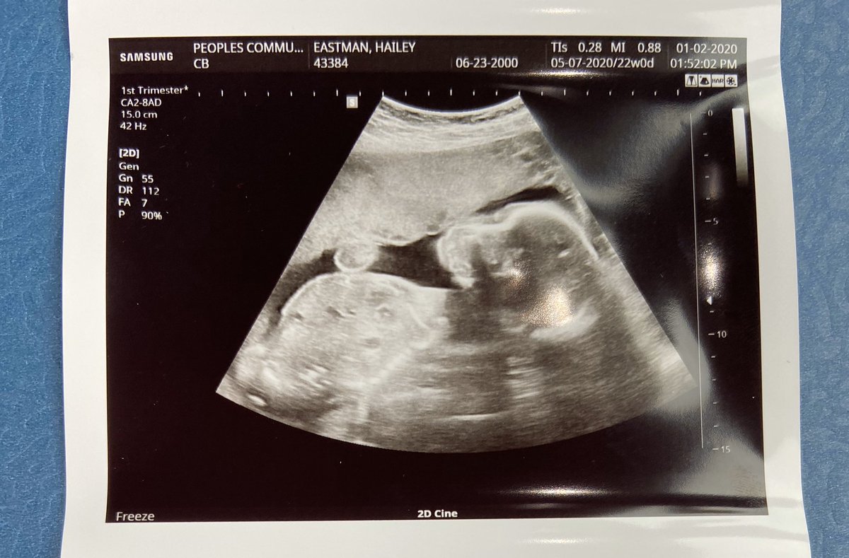 Haiileybrookee's tweet image. baby k. #22weeks#BABYBOY💙👣