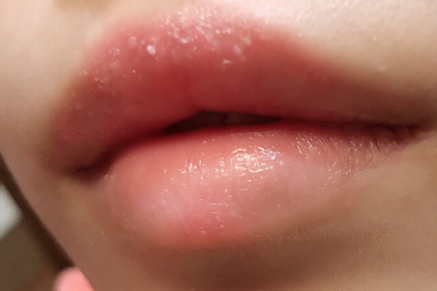 エノ 自分の唇コンプだから載せるか迷ったけど このガッサガサ 角質が溜まりまくりの唇がレブロンのキス シュガースクラブ使った後 モアリップこんもり塗って寝たらつるんぷるんに戻るから ほとんどのリップで荒れる唇弱々の私でも1日で復活できるの 試して