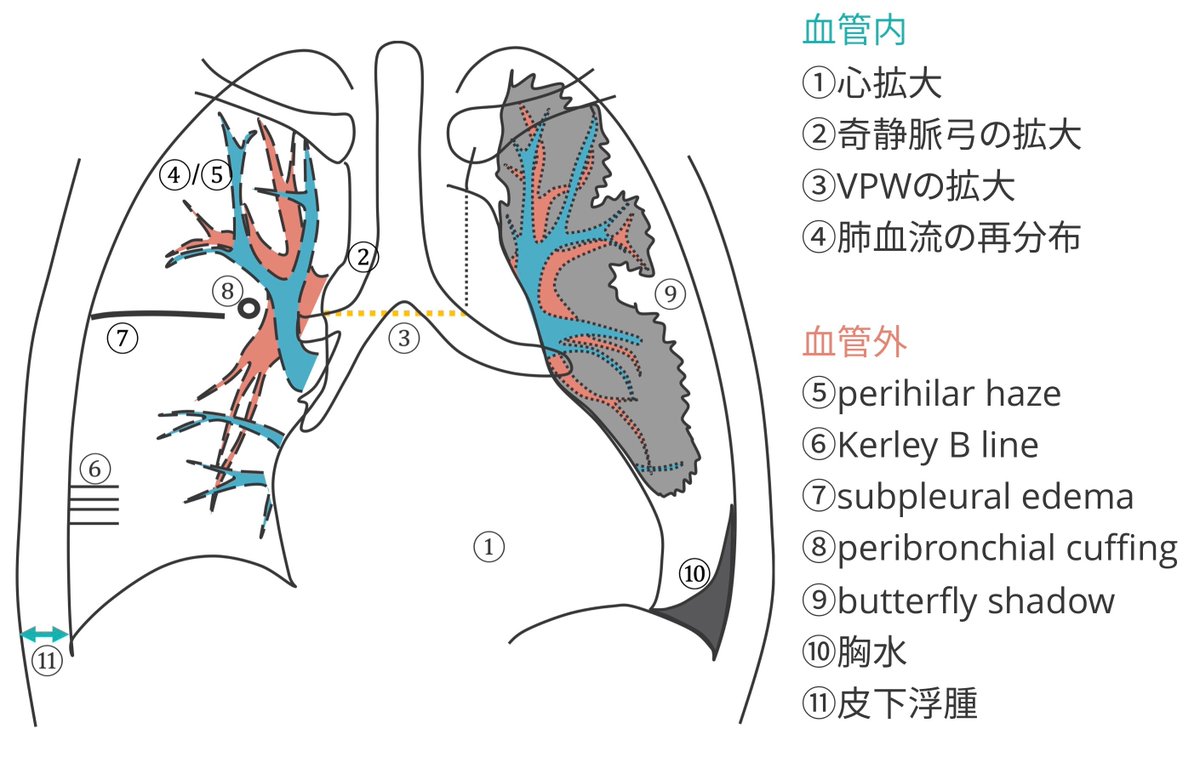 和田 武 (画像診断/IVR医) tweet media