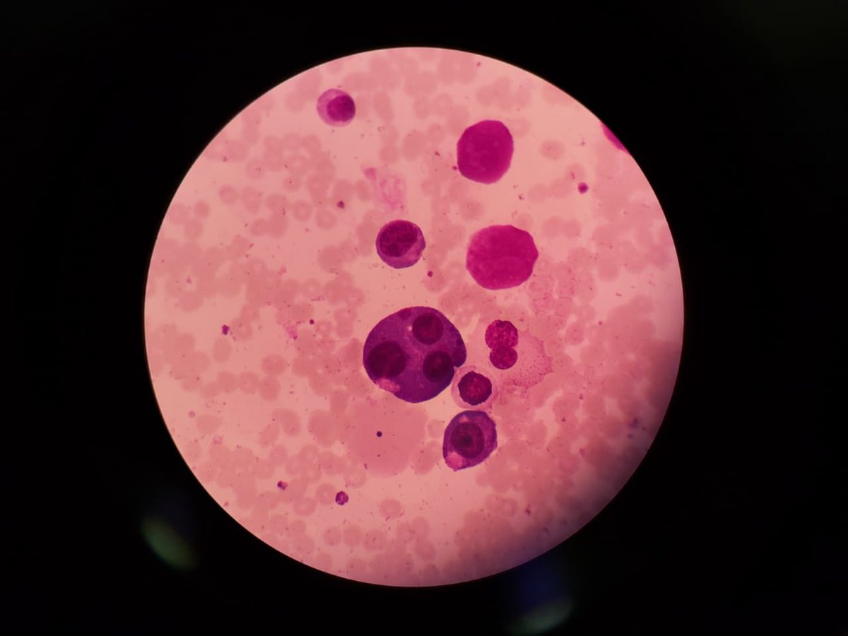 arum_arum's tweet photo. Multinucleation of pronormoblast https://t.co/U4lacxTFcA