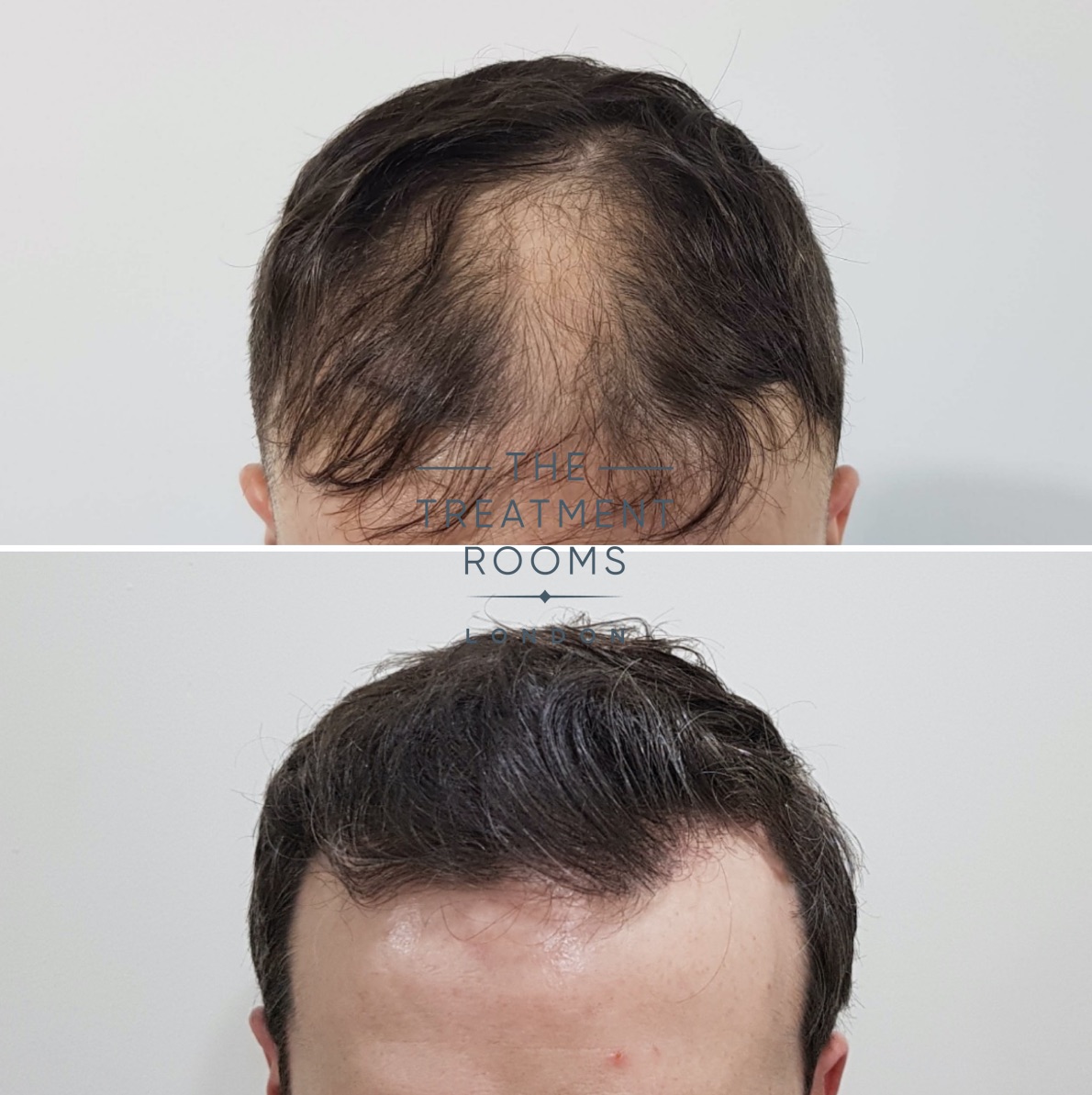 treatmentroomslondon on Twitter: treatmentroomslondon on Twitter: