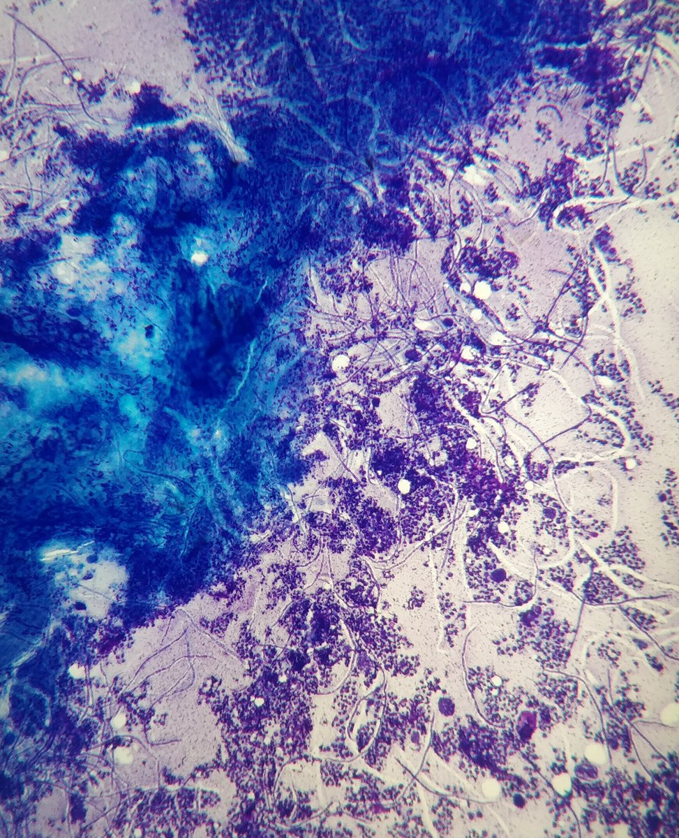 Anshuman Sinha MD tweet media