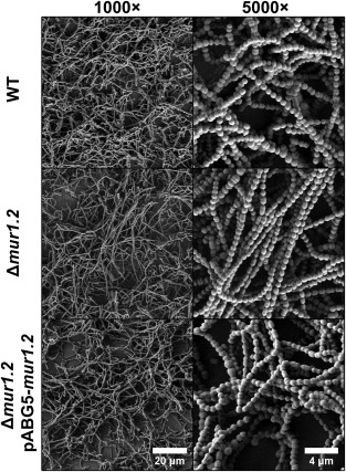 susanstorm62's tweet photo. Cellular chaining influences biofilm formation and structure in group #AStreptococcus
https://t.co/UewWzDZaLc https://t.co/KLZGZmUvdk