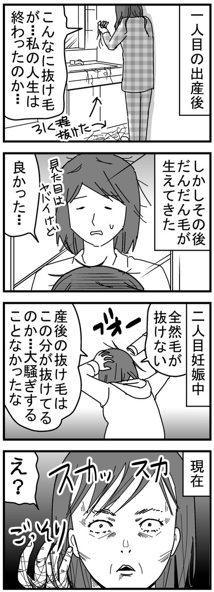 こんな感じで一時はどうなるかと思いましたが、少しずつ抜け毛も減り、新しい毛が生えてきました。でもまだスカスカです。ちゃんと生えますようにと毎日揉んでいます…。
#育児漫画