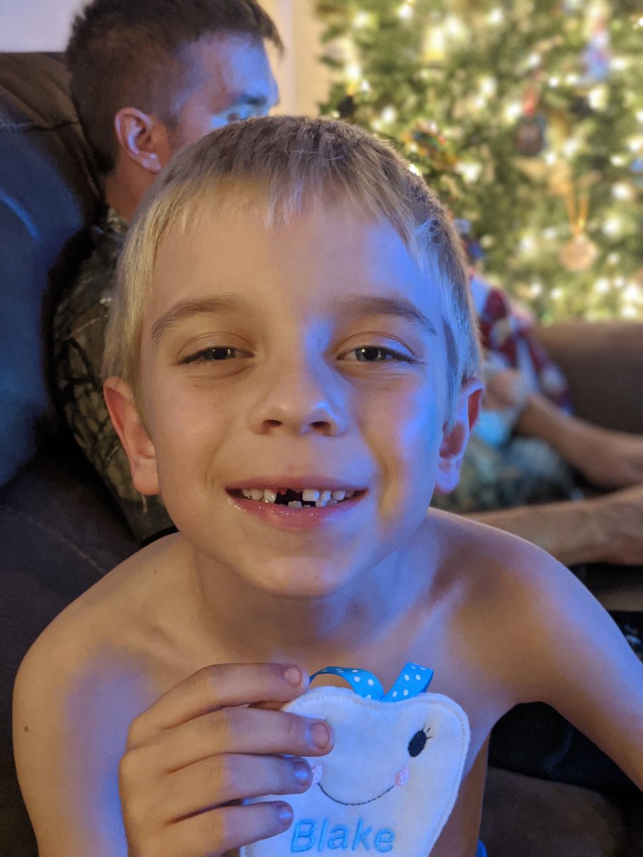 bexweso's tweet image. Toothfairy is comin' tonight🦷🧚‍♀️💰

#LostTooth #FrontTooth #ToothFairy