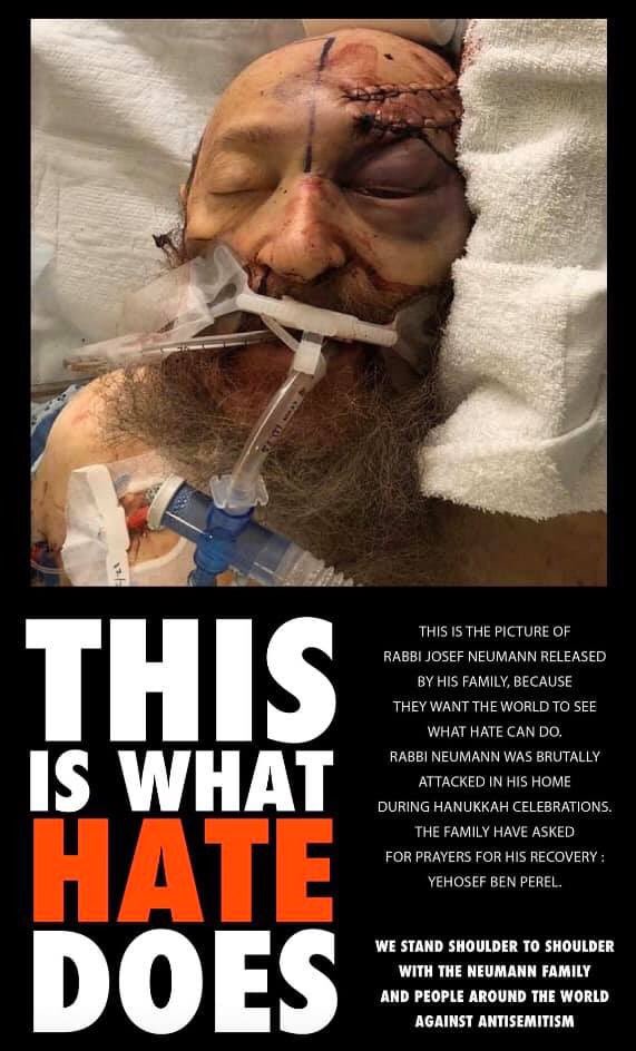 BigMikeMusic01's tweet photo. At request of his family, please REPOST this photo of Rabbi Josef Neumann using hashtag #WeJew THIS IS WHAT HATE LOOKS LIKE https://t.co/NIuzLMYxCE
