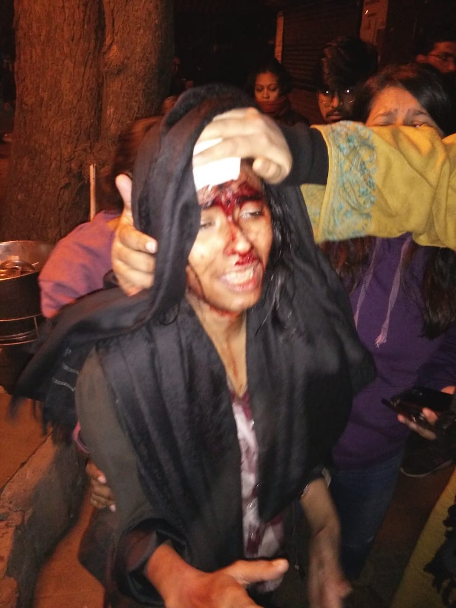 MUNEERA38926641's tweet photo. It's really bad situation in the JNU. Shame on you those having powers. 
#abvpviolenceinjnu #jamia_stands_with_jnu
#SOSJNU
#shameondelhipolice https://t.co/xYyEiOJLPs